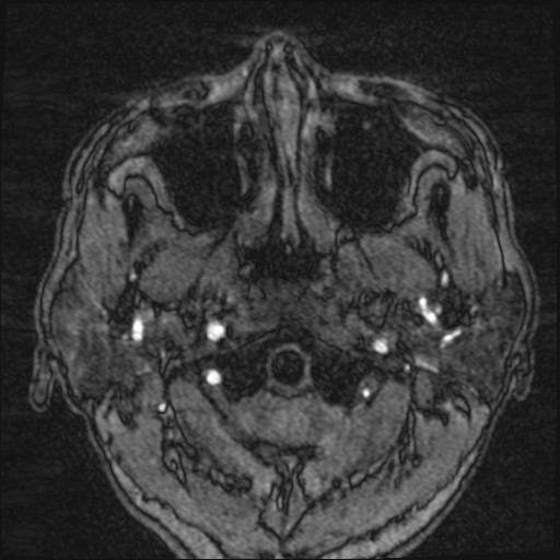 Click on the Serie image to view the images of VILLANUEVA, WILLIAM A.